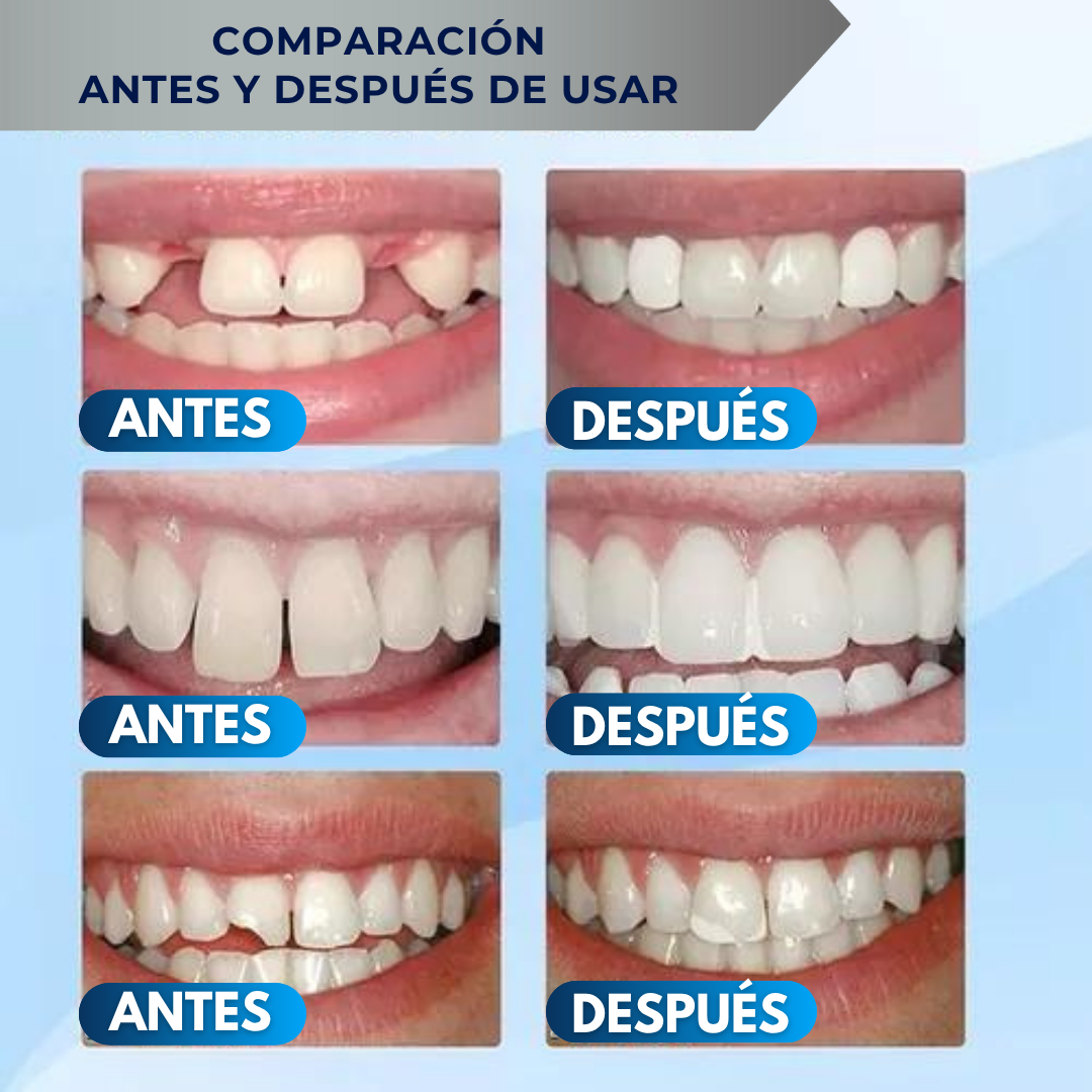 Kit de Reparación Dental Instantánea